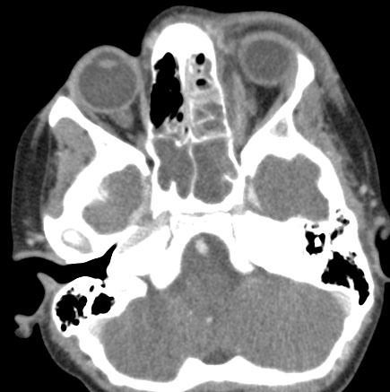 Case Image