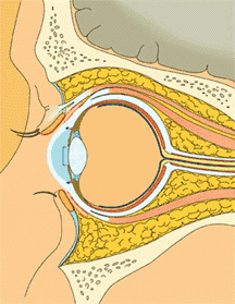 Pre-septal cellulitis
