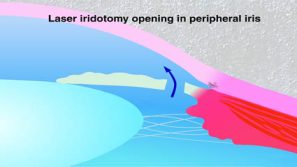 To save this image to your computer, right click on the image and select 'Save Image As'