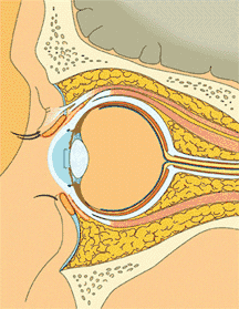 Post-septal cellulitis